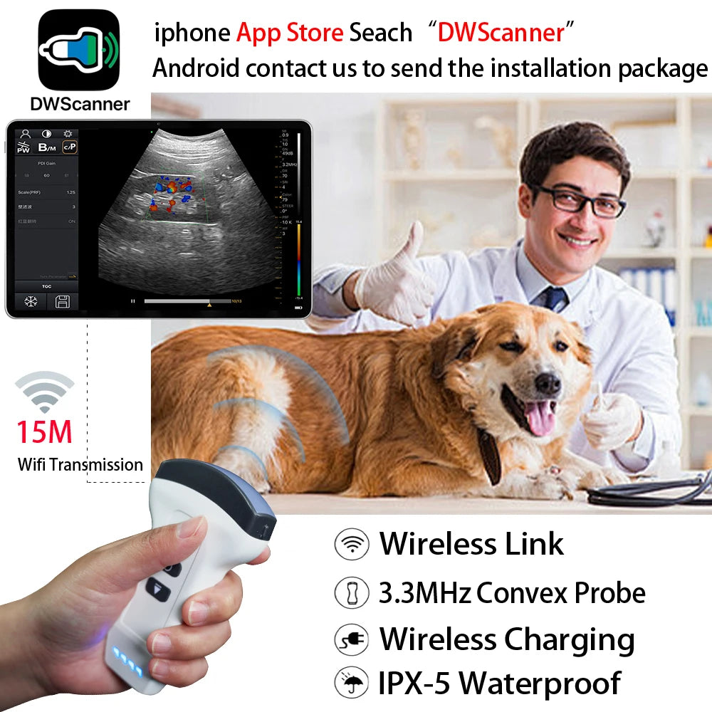 Wireless Color Doppler Ultrasound Scanner