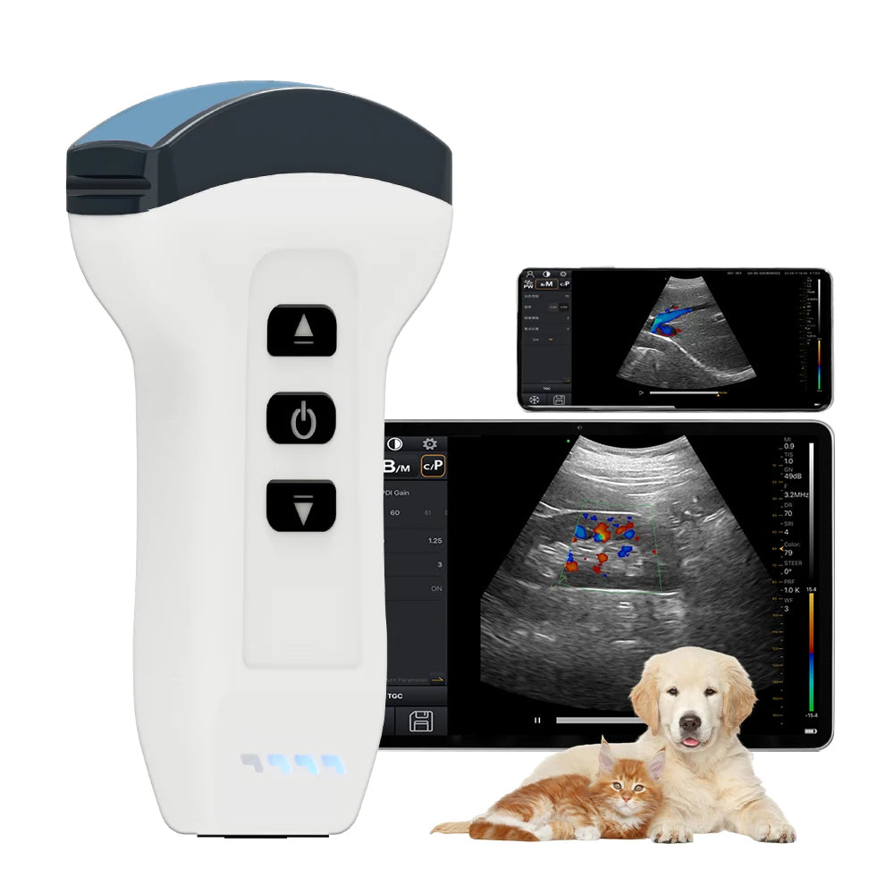 Wireless Color Doppler Ultrasound Scanner