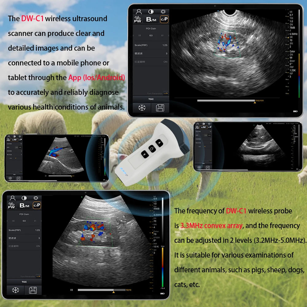 Wireless Color Doppler Ultrasound Scanner