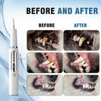 Ultrasonic Toothbrush